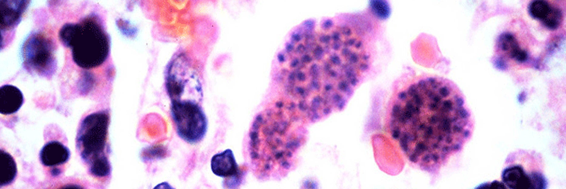 iStock- Toxoplasma